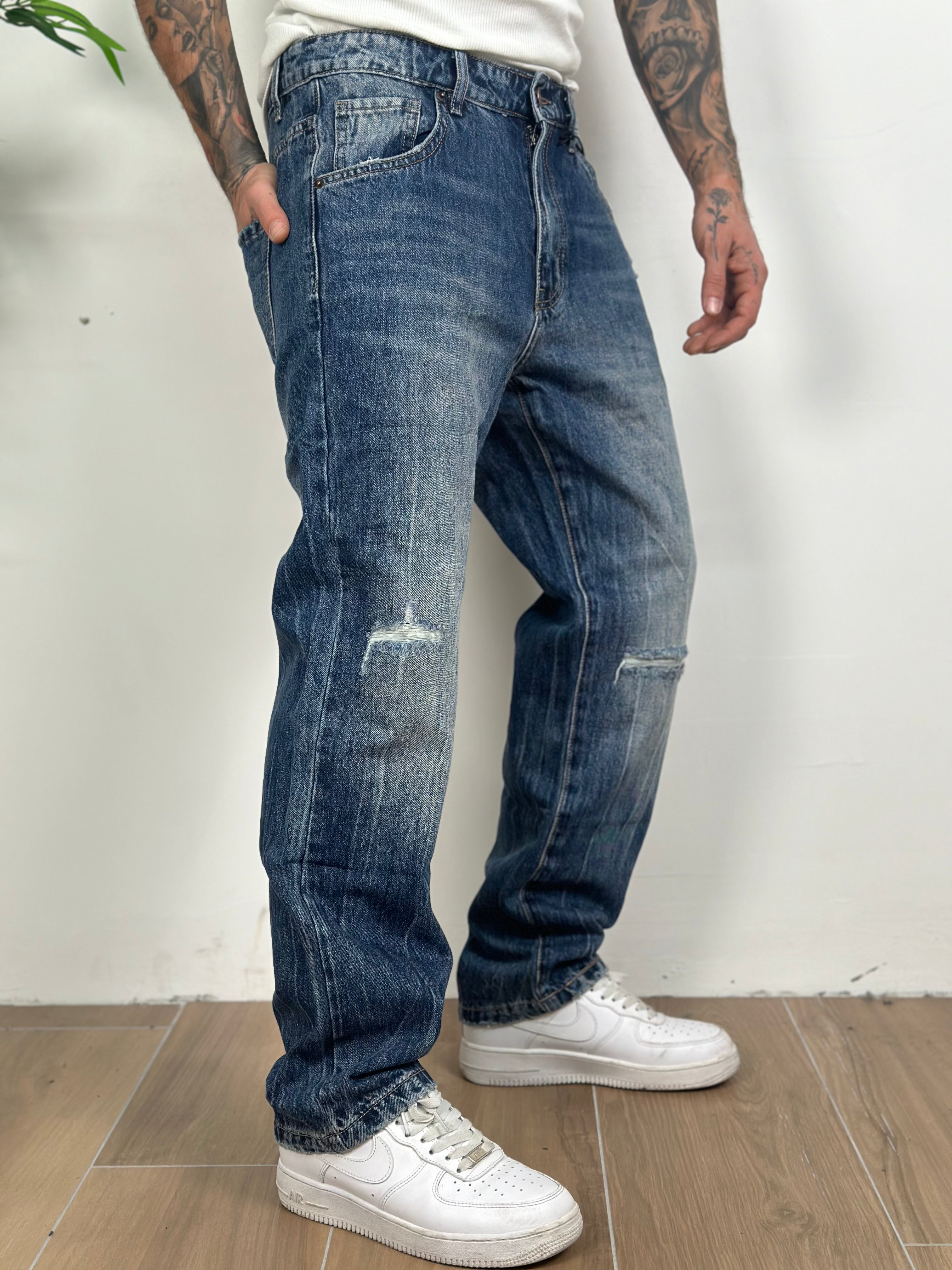 baggy rupture